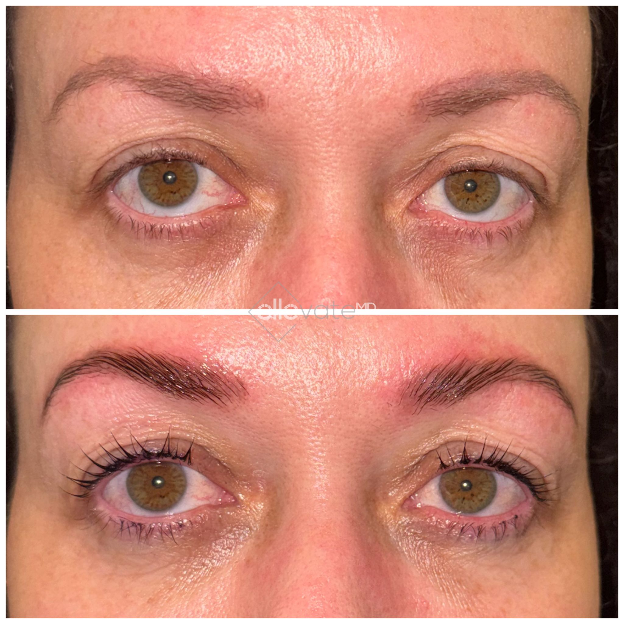 Before and after lash lift treatment showing enhanced lash curl and definition